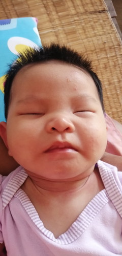 การแพ้
