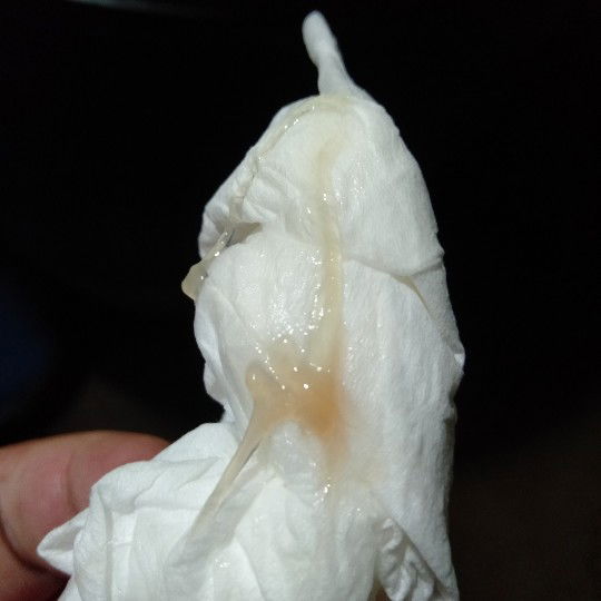 อาการใกล้คลอด