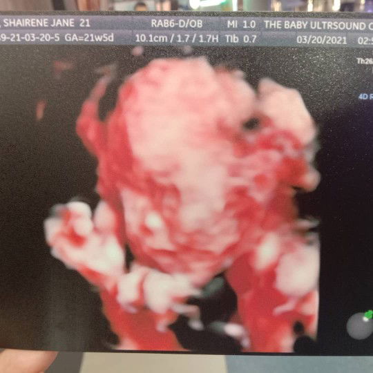 Shairene Jane Lapag Jaime profile icon