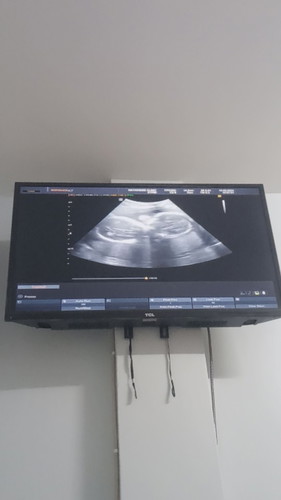 ท้อง2 แพ็คคู่