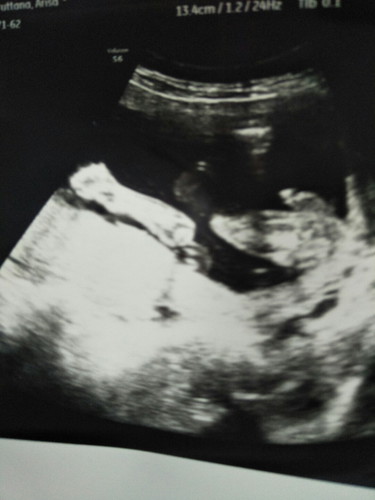 ตั้งครรภ์