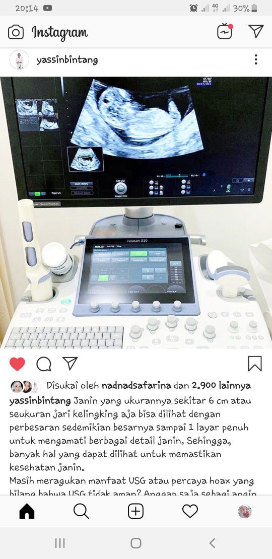 MITOS GA BOLEH SERING USG