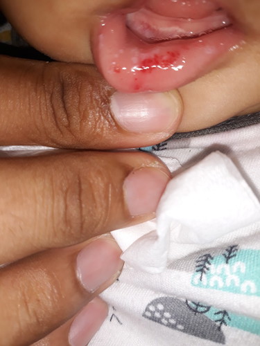 Bayi 6 bulan