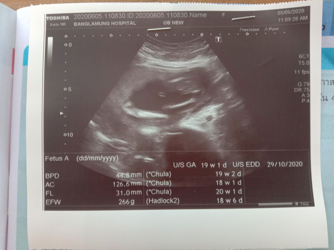 ดูลูกตรงไหนหรอคะ