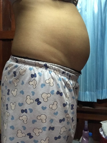 ลักษณะท้องแหลม/กลม