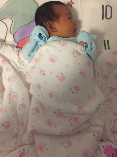 ลูกนอนหงายตะแคงแต่ศีรษะ