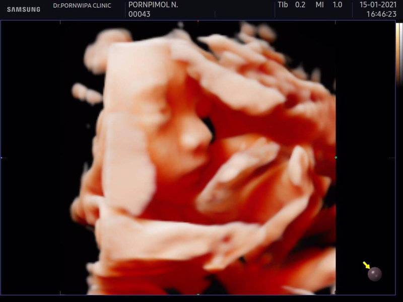 Pornpimon Niamkhunthod profile icon