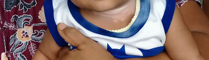 Cara menghilangkan bekas ruam pada bayi dikasi apa ya Bun??bekasnya putih2 kayak belang2 pada leher