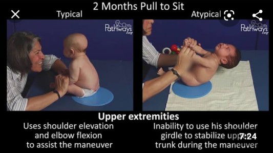 Tumbuh Kembang Bayi 3 Bulan