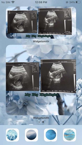 Gender reveal ultrasound