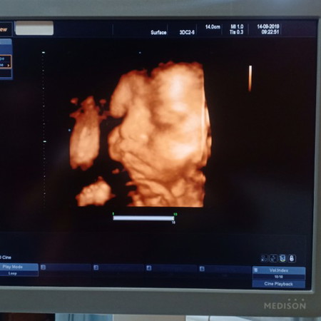 นู๋ชื่อ น้องซัมเมอร์ ค่ะ