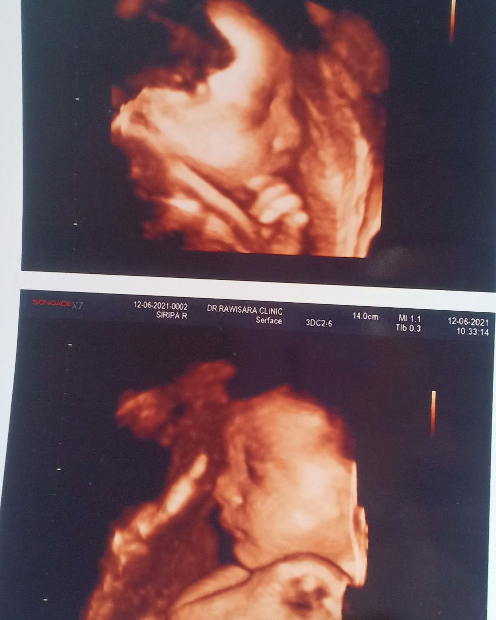 siripa Ramsiri profile icon