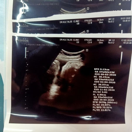 37+1 น้ำหนักลูก 3678กรัม