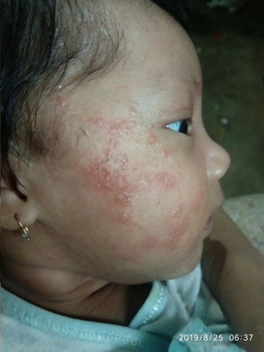 bayi