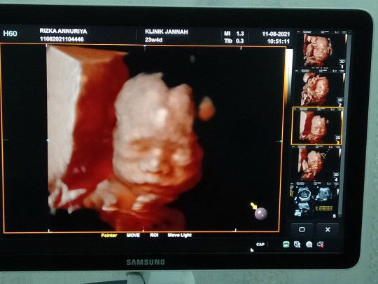 rizka annuriya profile icon