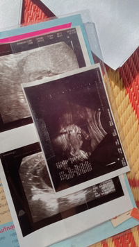 Pathachada Yaprom profile icon