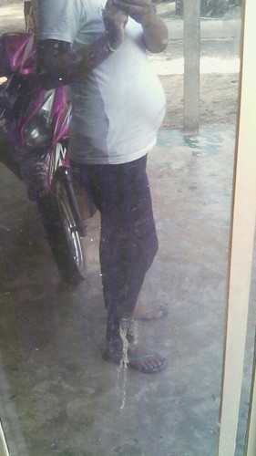 ฝากถึงคุณแม่ที่กำลังกังวนเรื่องท้องเล็กท้องใหญ่