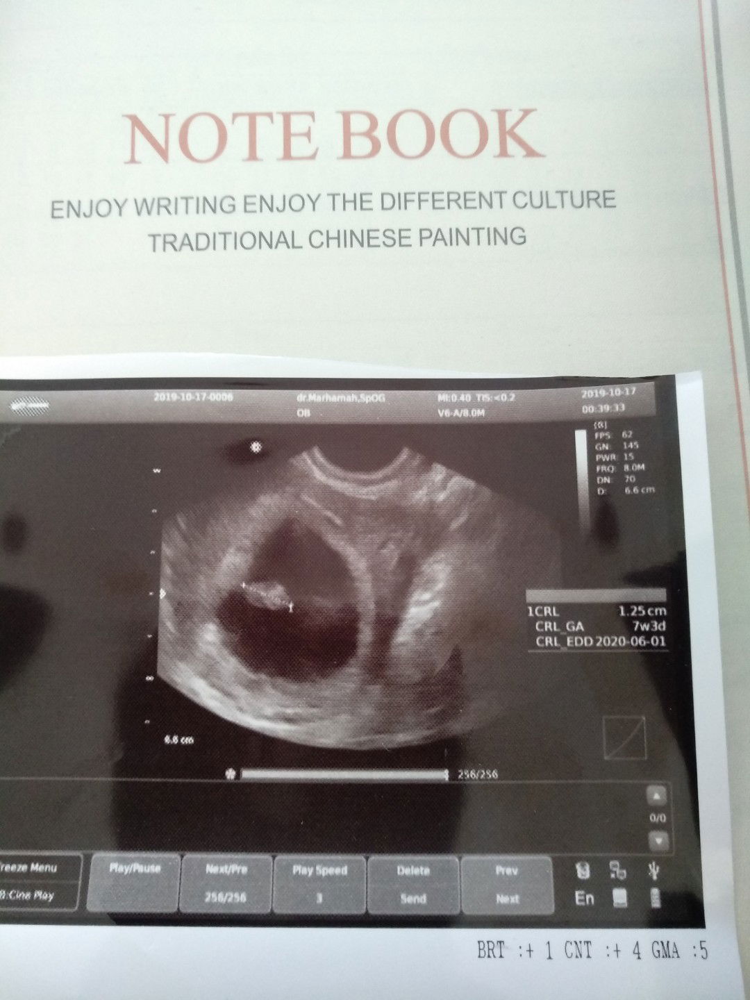 Butuh kata2 positif dan doa biar semangat