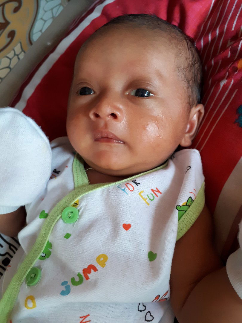 Bintik merah pada bayi