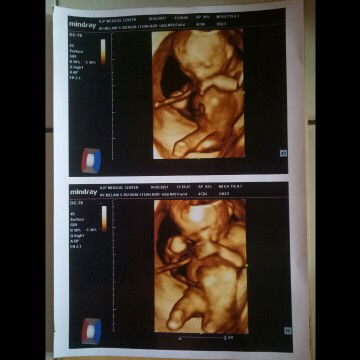 Melan Suhaemi profile icon