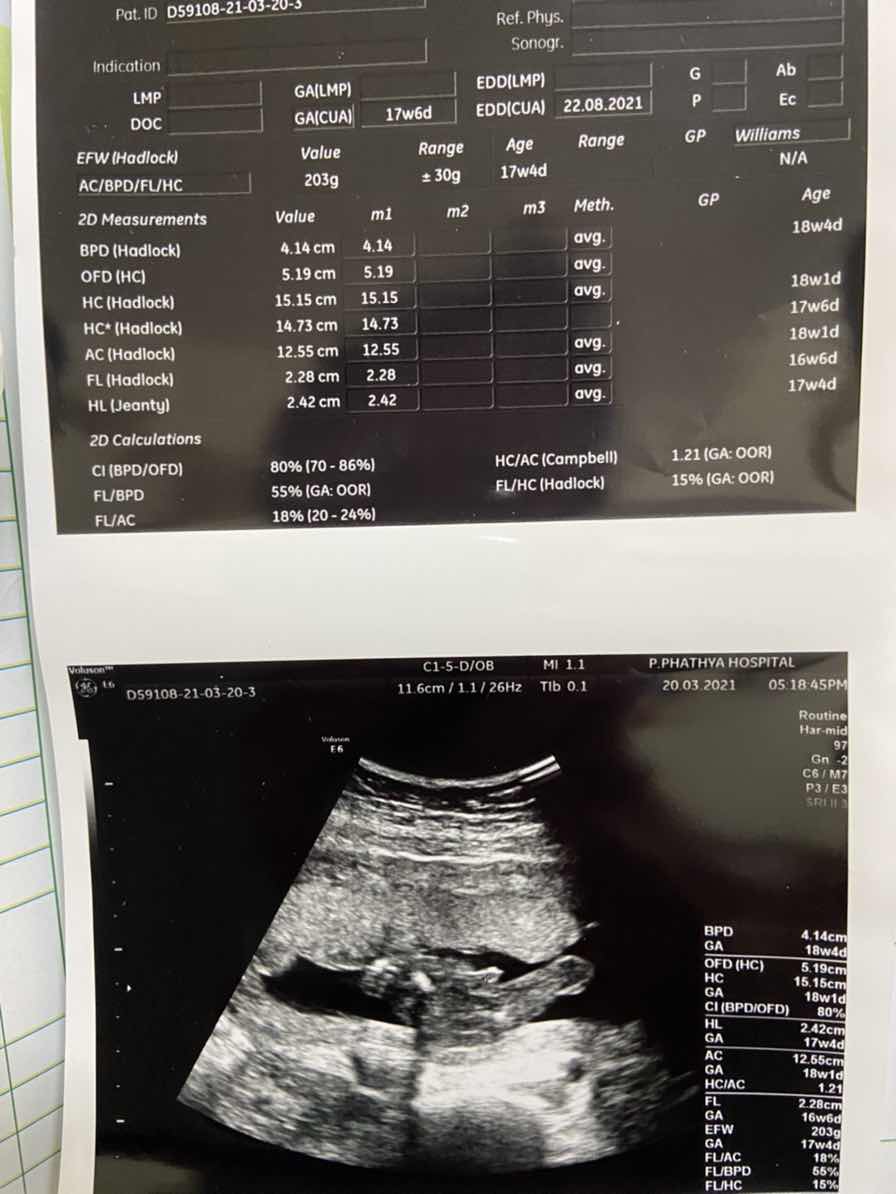 รู้เพศแล้วววววว ลุ้นทุกวันเลย