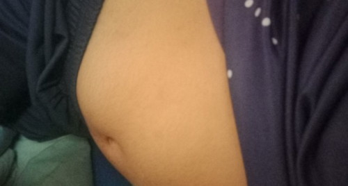 19W4D ท้องไม่ออกเลยจ้า
