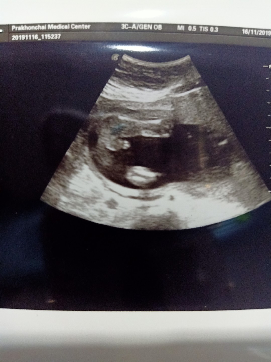Post reply image