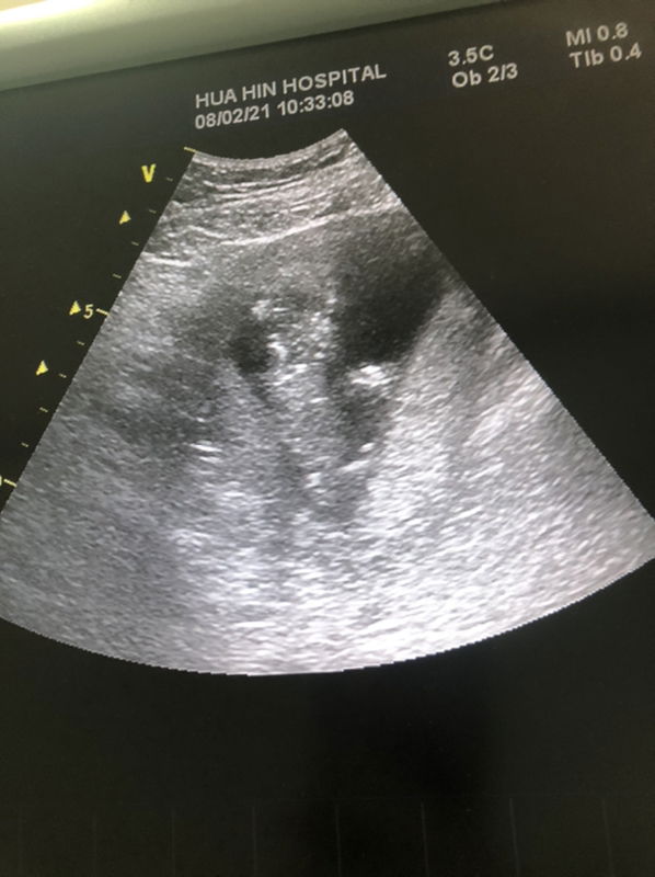 Fongbeer Pinkeaw profile icon