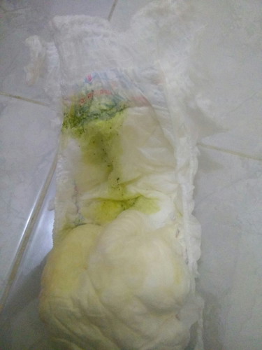 Kenapa Ya? Pupnya gini