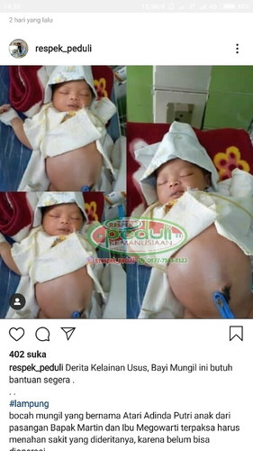 Bagi yg ingin donasi di persilahkan Bun..