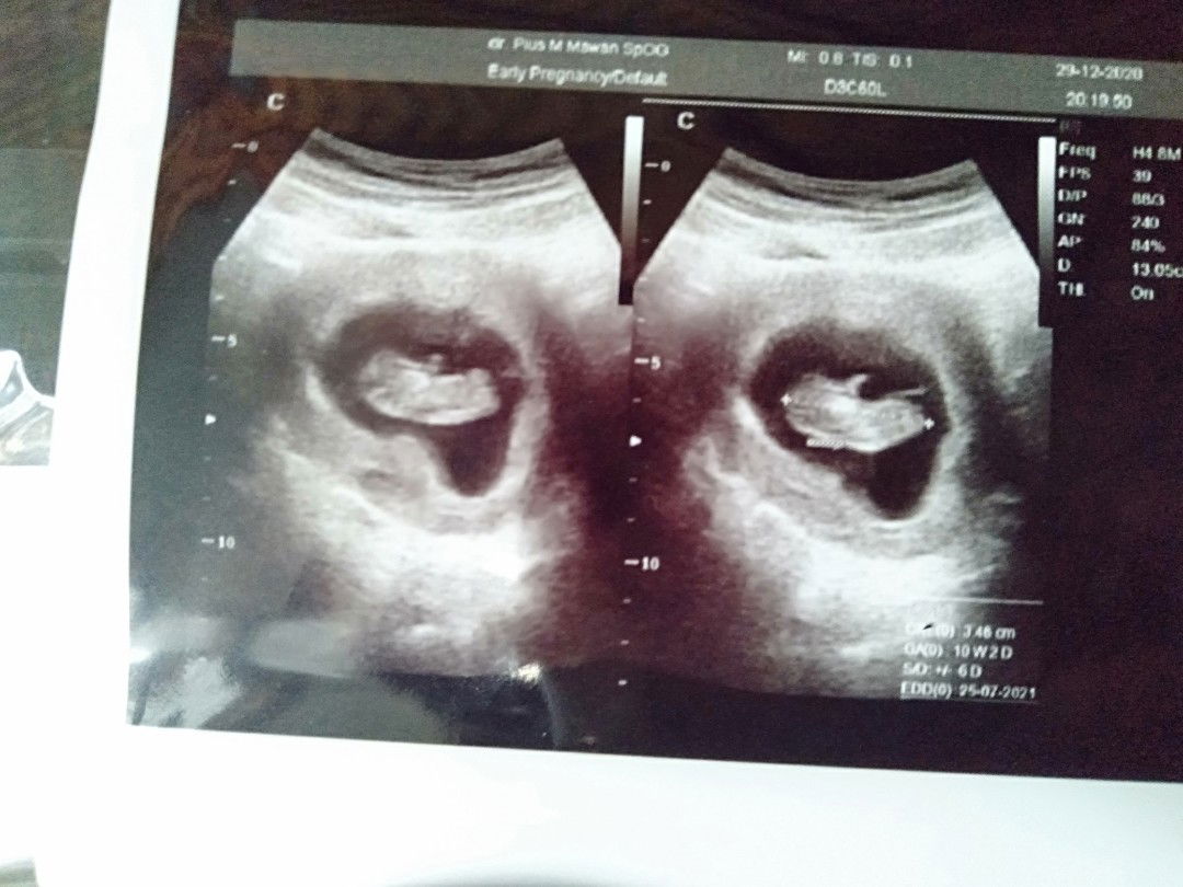 Anita Wulansari Maulinda profile icon