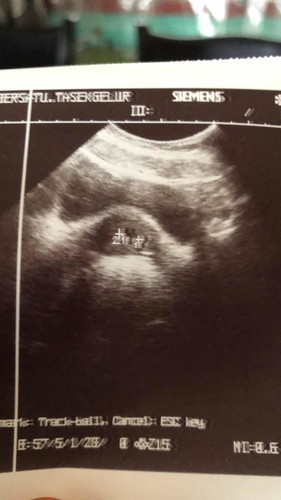 ada yang penah alami mcm saya tak?