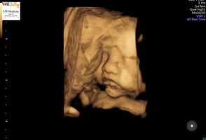 Yesenia Nunez profile icon