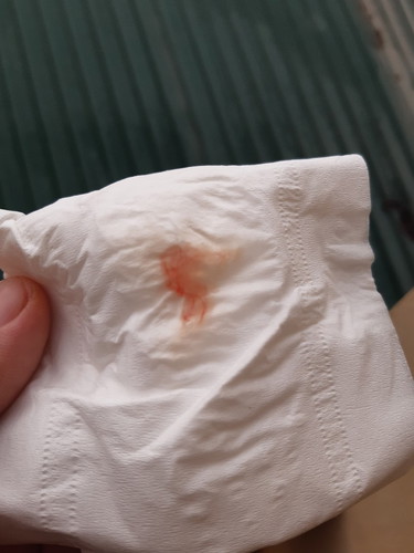 Mn cho e hỏi ra cái này với khó chịu bụng dưới có phải sắp sinh k