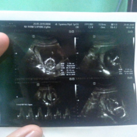 jenis kelamin