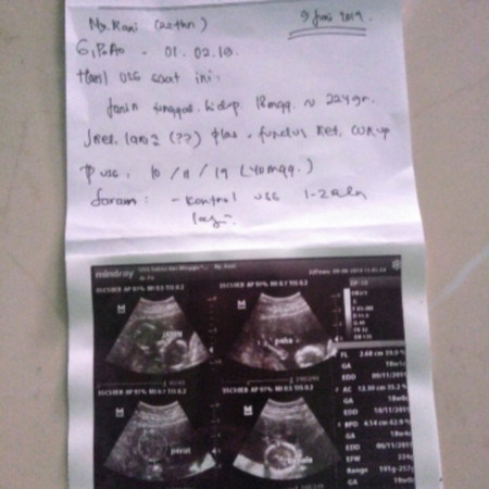Babyboy?