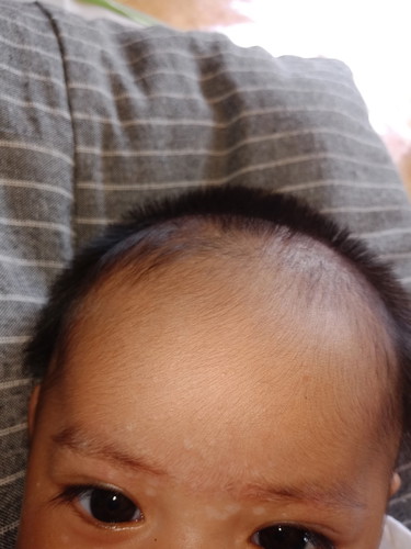 dimuka