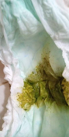 14 month-old DIARRHEA, please help ?