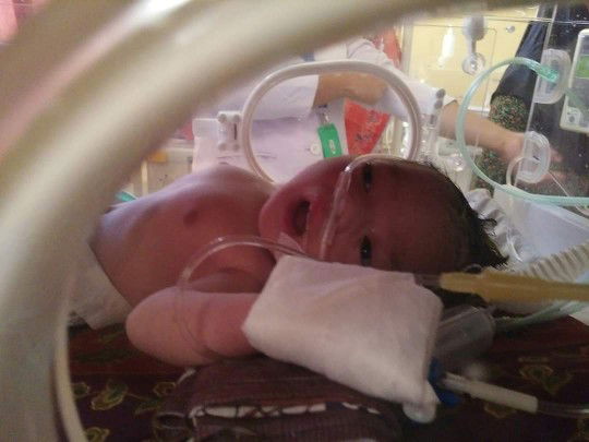 Baby newborn biru dan sesak nafas