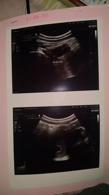 รวิ profile icon