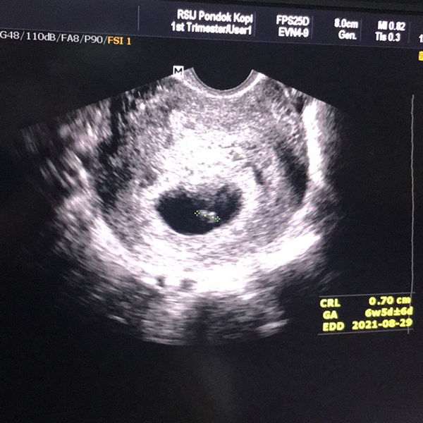 Wenni Agustin profile icon