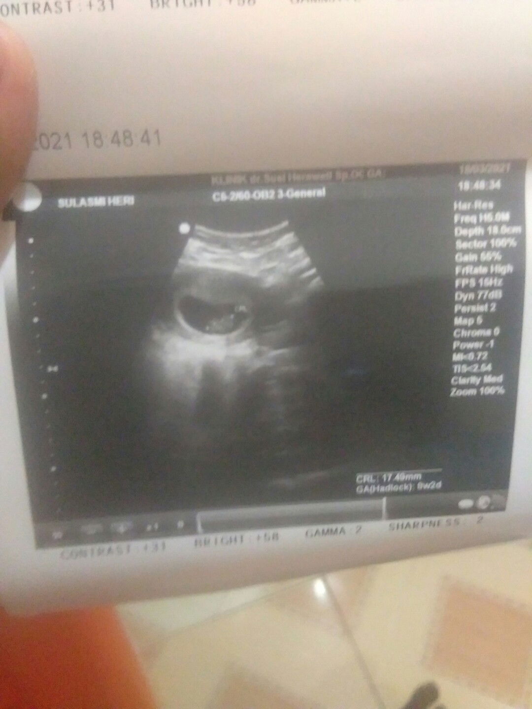 Ibu super profile icon