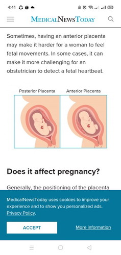 Anterior Placenta