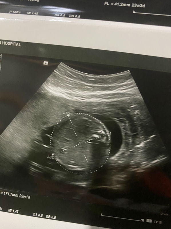 Arriya Bunprasit profile icon