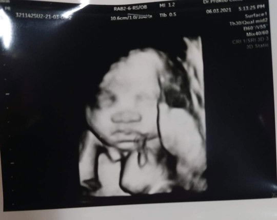 chanakan profile icon