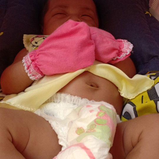 Pusar berair ada seperti nanah