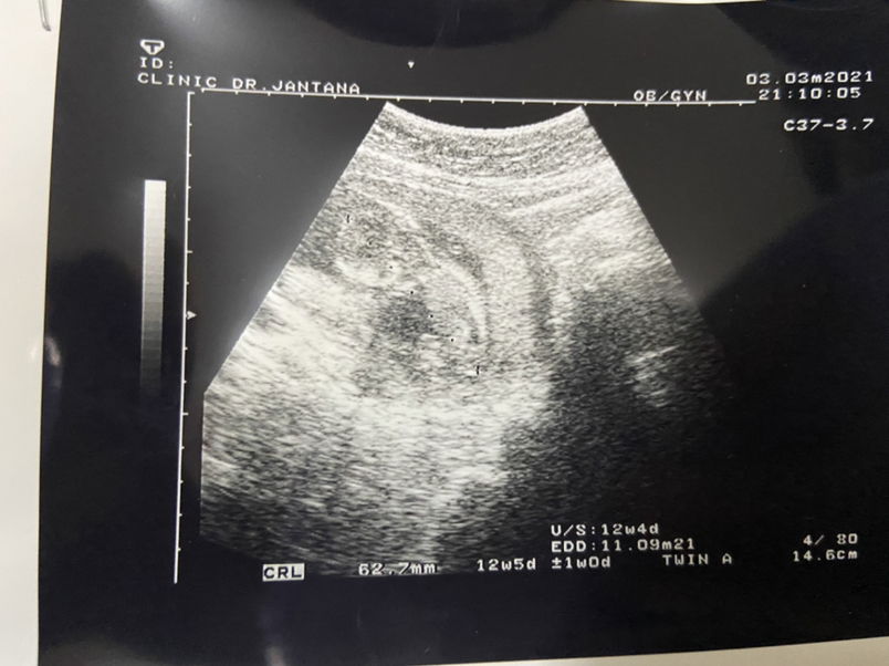 sunee mahawan profile icon