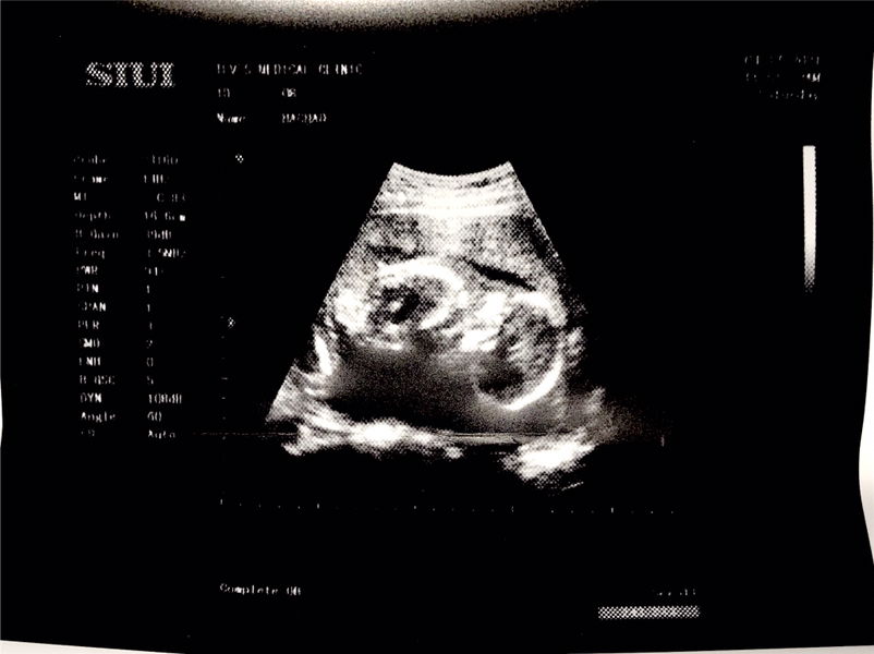 First Baby profile icon