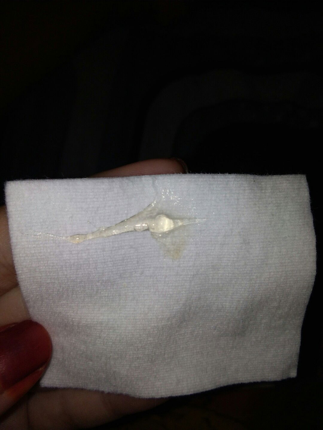 keluar lendir bening