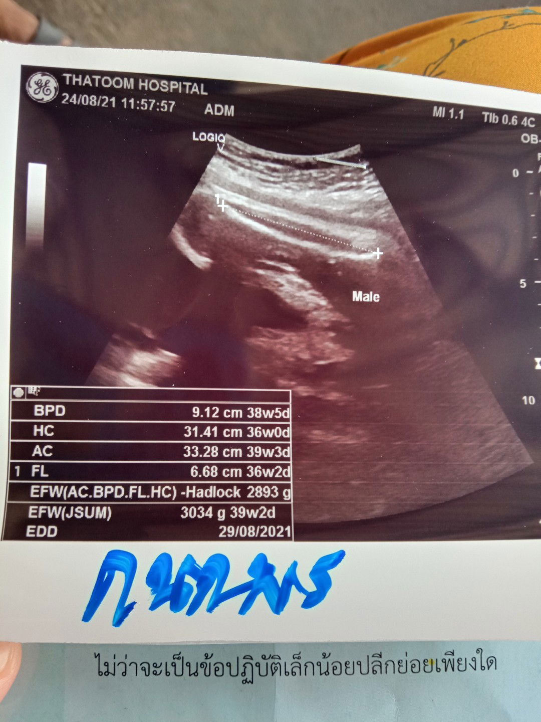 เราควรยึดอายุครรภ์จากอันไหนดีค่ะ